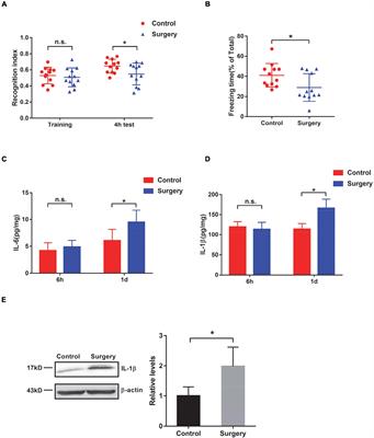 Hippocampus-Based Mitochondrial <mark class="highlighted">Respiratory Function</mark> Decline Is Responsible for Perioperative Neurocognitive Disorders